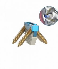 Pallas Low Profile Anterior Cervical Cage